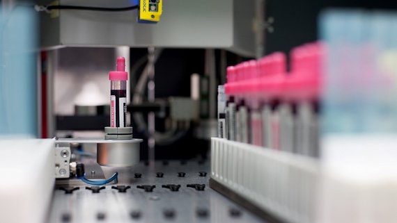 Proben im Labor